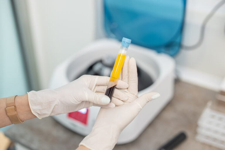 How to Prepare for Your P Shot in Dubai Session