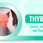 Thyroid: Causes, Symptoms, and Treatment