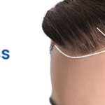 Hairfall Checkup Package in Hyderabad for Accurate Root Cause Diagnosis