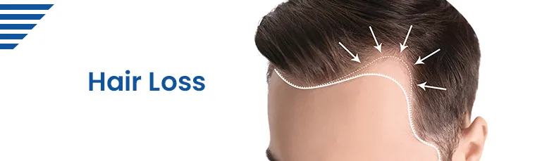 Hairfall Checkup Package in Hyderabad for Accurate Root Cause Diagnosis