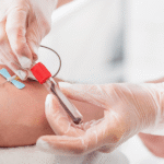 Blood Test at Home for Vitamin D Deficiency