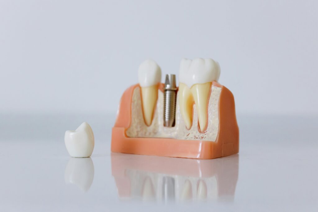 Top Benefits of Visiting Bridge Family Dental Regularly