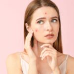 Acne Treatment in Dubai: Winter vs Summer Skincare Tips