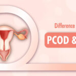 The Difference Between PCOD & PCOS – FFD