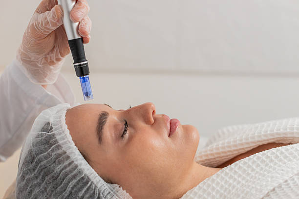 Dermapen Microneedling Device in Dubai for Neck & Décolletage