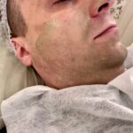 Green Peel Treatment in Dubai: Specialized Care for Men
