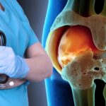 Traditional vs Robotic Knee Surgery: What Patients in Delhi NCR Should Know