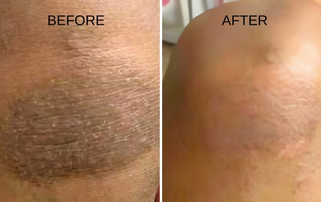 A Better Way to Nourish Dry, Sensitive Skin