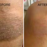 A Better Way to Nourish Dry, Sensitive Skin