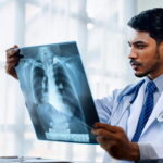 Best Pulmonologist in Hyderabad for Breathing and Lung Health Care