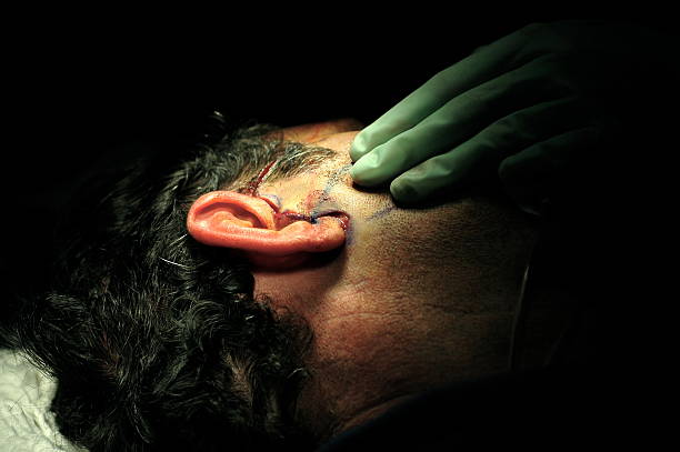 Ear Reshaping in Dubai: Permanent Otoplasty Solutions