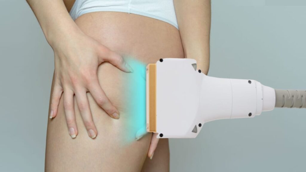 Laser Liposuction for Thigh Fat Reduction Explained