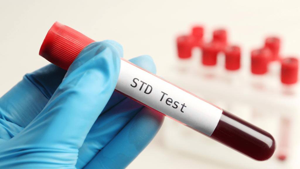 Herpes STD Test in Dubai: Swabs, Blood Tests, and Accuracy
