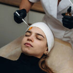Can Glycolic Peel Treatment in Dubai Fix Acne Scars Effectively?