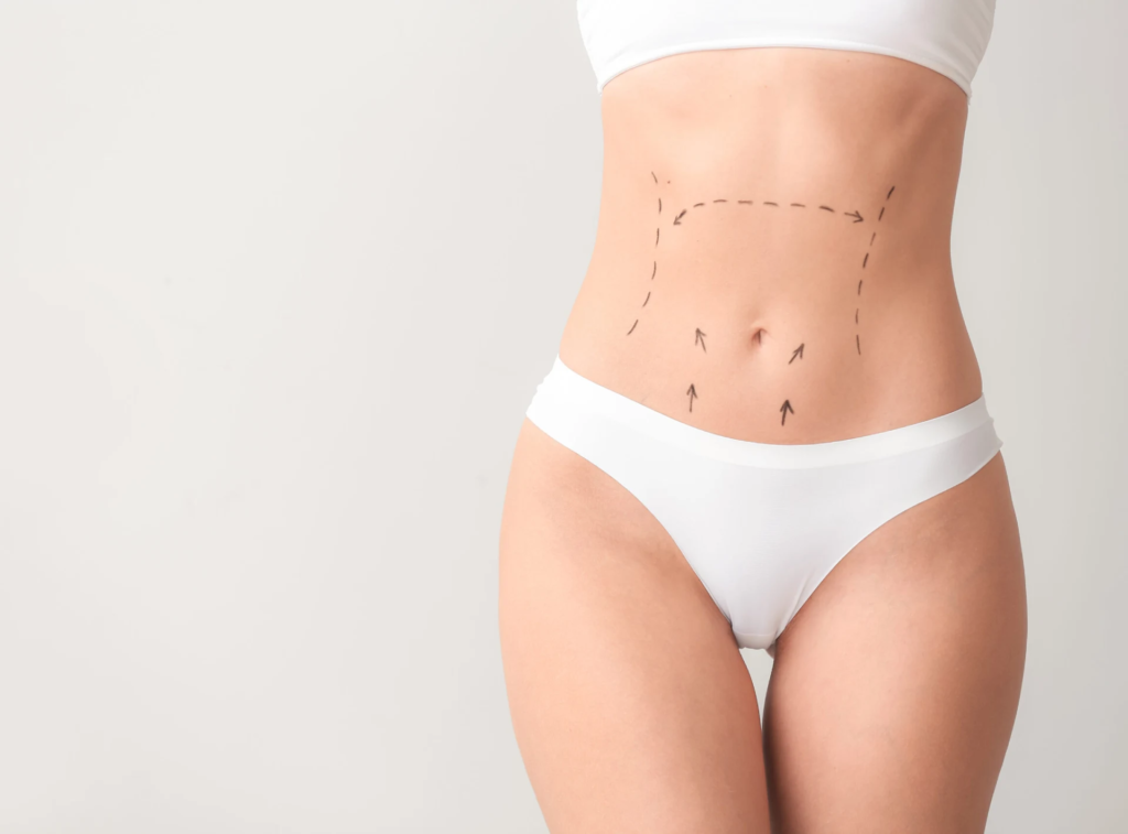 Non-Surgical Alternatives to Liposuction