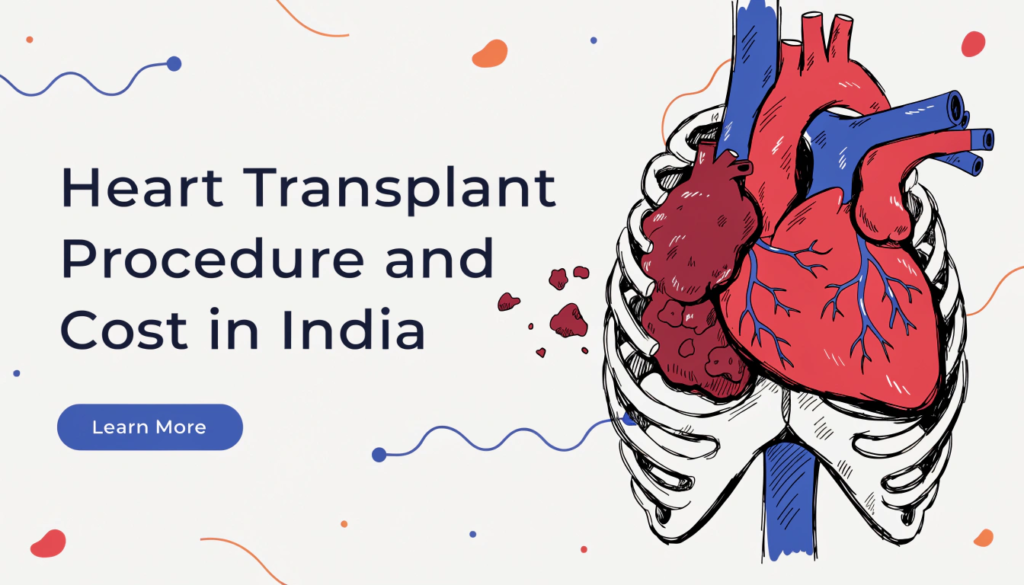 Heart Transplant Procedure and Cost in India
