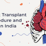 Heart Transplant Procedure and Cost in India