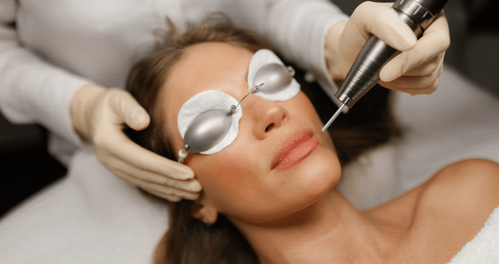 Fractional CO2 Laser Treatment for Hyperpigmentation Explained