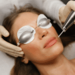Fractional CO2 Laser Treatment for Hyperpigmentation Explained