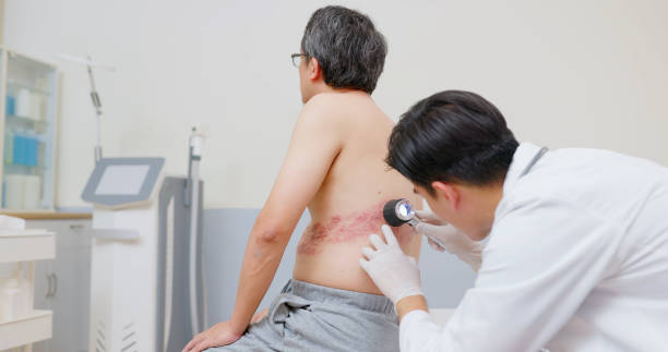 Stress Management & Skin Disease Treatment in Dubai