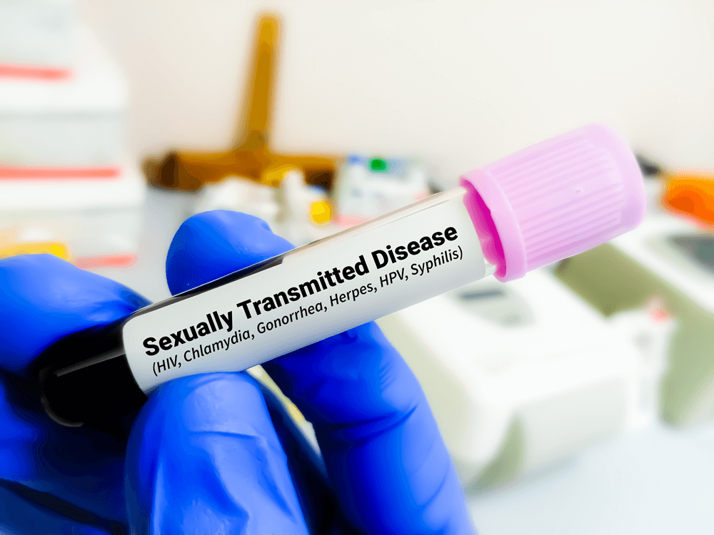 Sexual Health & Lifestyle in Dubai | 5 Habits for Prevention