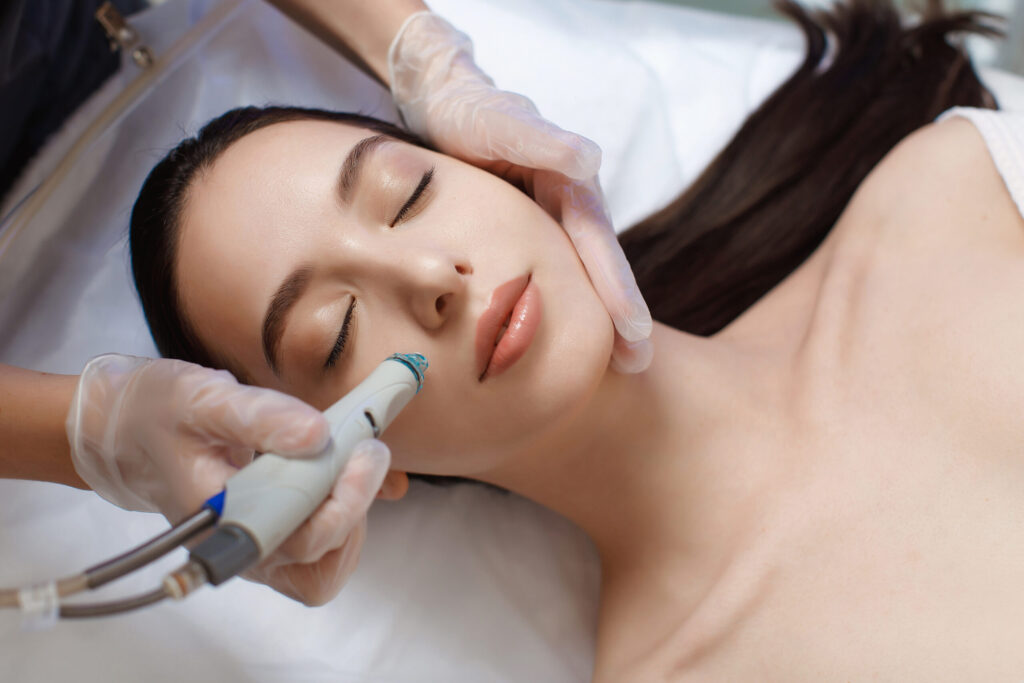 Why Is Hydrafacial a Gentle Yet Powerful Solution for Acne-Prone Skin?