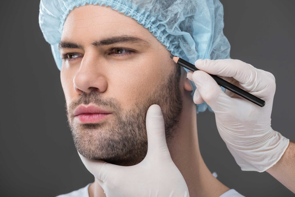 How Do Beard Transplants Improve Facial Balance and Definition?