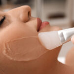 Do Chemical Peels Help Reduce Fine Lines and Wrinkles?