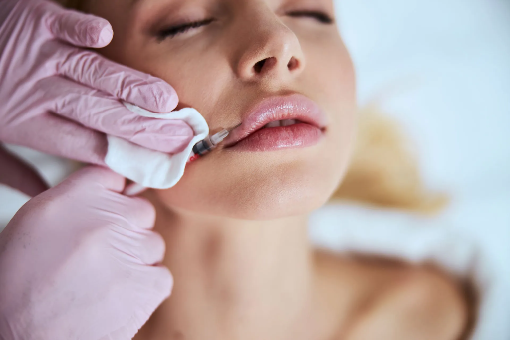 Why Lip Fillers injection creates irresistible lip volume appeal?