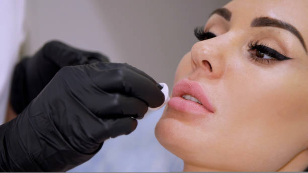 Genetic vs. Acquired Lip Pigmentation Treatment in Dubai