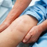 Bilateral Knee Replacement Surgery: A Complete Guide to Making the Right Choice