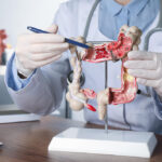 Benefits of Consulting a Colonoscopy Specialist in Florida