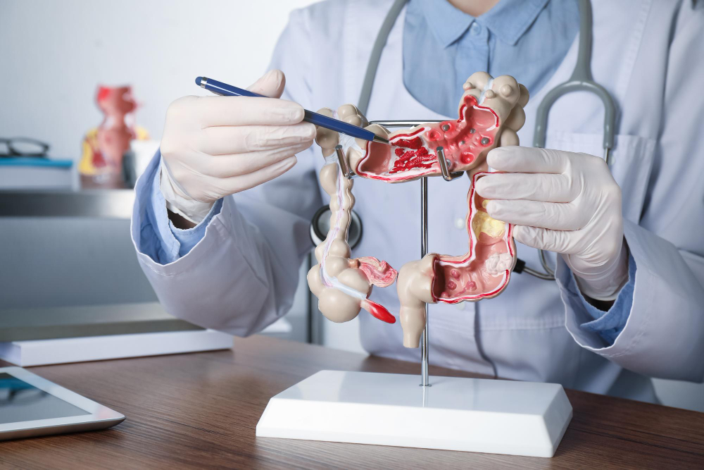Benefits of Consulting a Colonoscopy Specialist in Florida