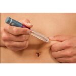 Who Is an Ideal Candidate for Androfill Injections?