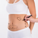 Liposuction in Dubai: A Journey to Body Confidence