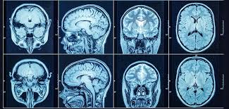 Comprehensive Guide to ct scan in bangalore: Everything You Need to Know