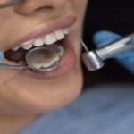 Best Dental Clinic in AECS Layout, Bangalore for Advanced Smile Care