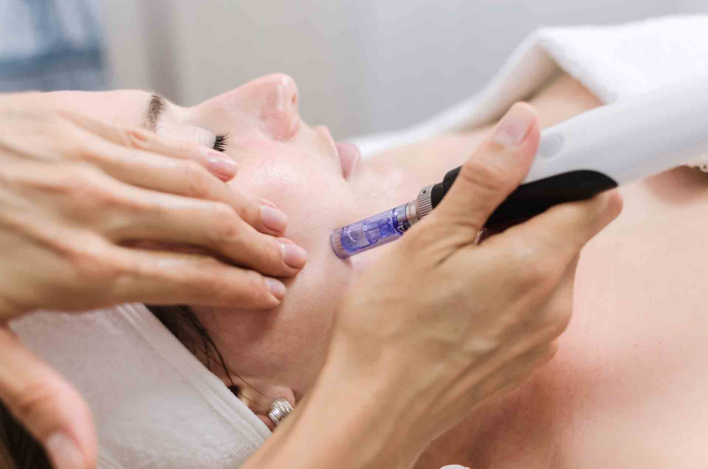 Microneedling Christiana – Rejuvenate Your Skin for a Youthful Glow