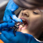 How to Reduce Your Wisdom Teeth Removal Cost in Ontario in 2026
