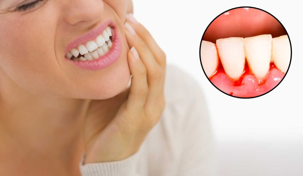 What is the fastest way to cure gum disease?