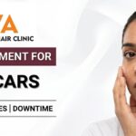Acne Scar Laser Treatment Costs in Pune: What You’ll Pay in 2026