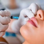 What Results Can You Expect From Juvederm Filler?