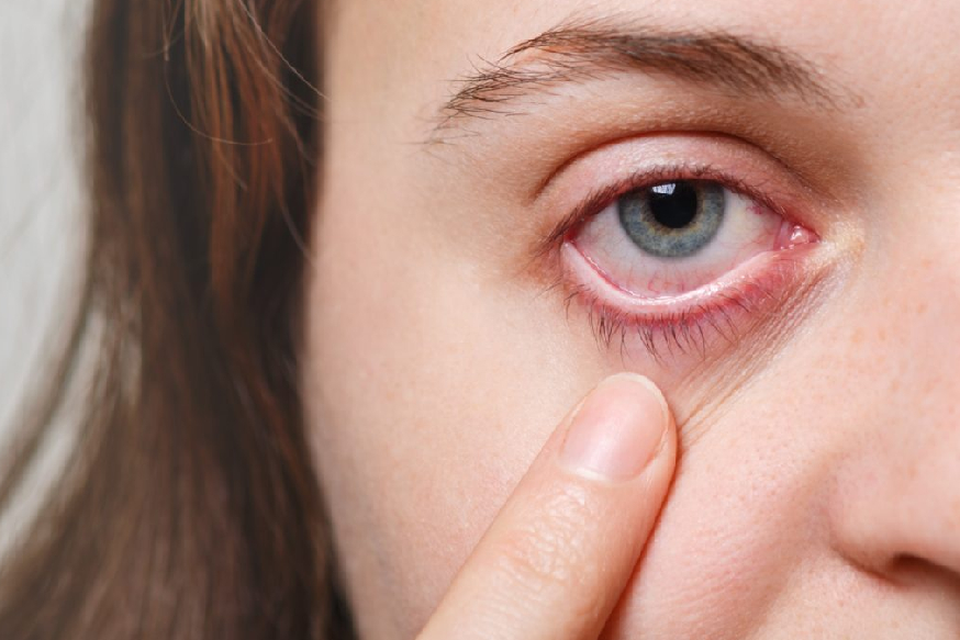 Complete Guide to Dry Eye Consultation and Effective Treatment Options