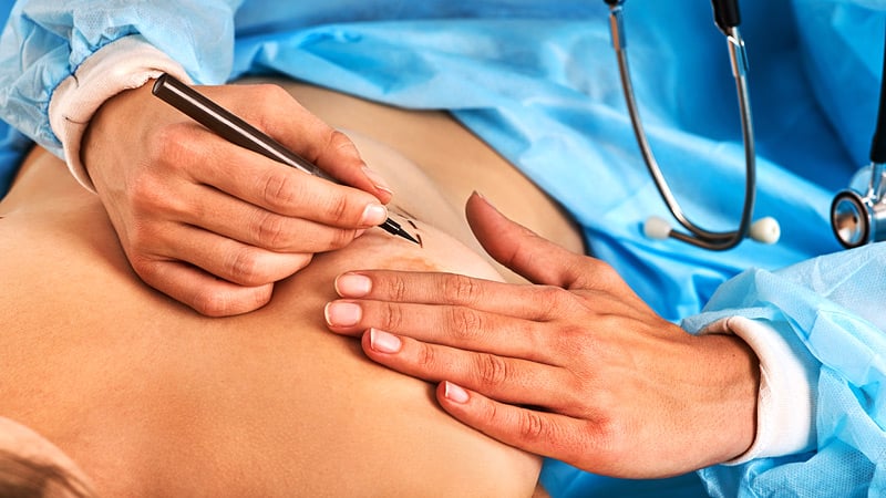 What Are the Latest Trends in Breast Lift Surgery?