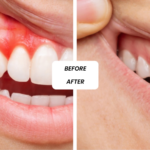 General Dentistry in Dubai: Everyday Dental Care for Lasting Oral Health