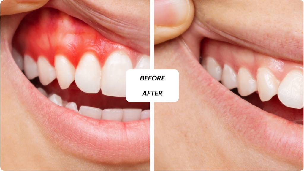 General Dentistry in Dubai: Everyday Dental Care for Lasting Oral Health