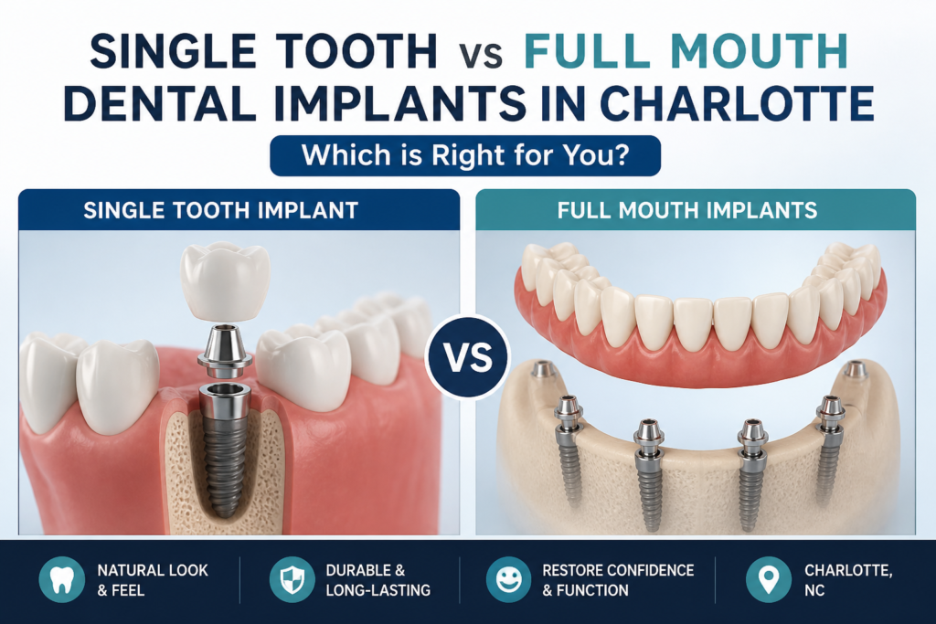 Single Tooth vs Full Mouth Dental Implants in Charlotte: Which is Right for You?