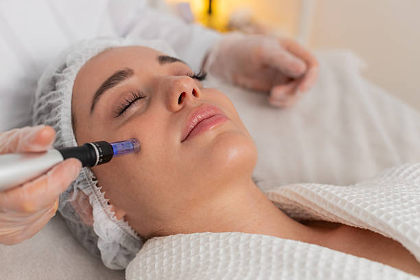Mesotherapy for Large Pores and Oily Skin: The Matte Glow Secret