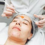 How Long Does PCA Peel Treatment Recovery Take Time?