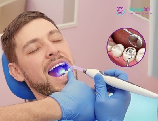 How Much Is It Per Tooth Filling in India?